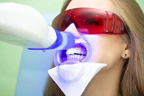 Laser teeth whitening treatments Essex