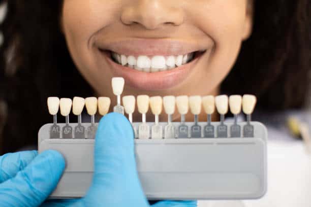 Laser Teeth Whitening: Exploring the Longevity of Your Brighter Smile Essex