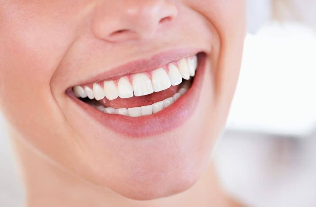 Teeth Whitening West Drayton Essex