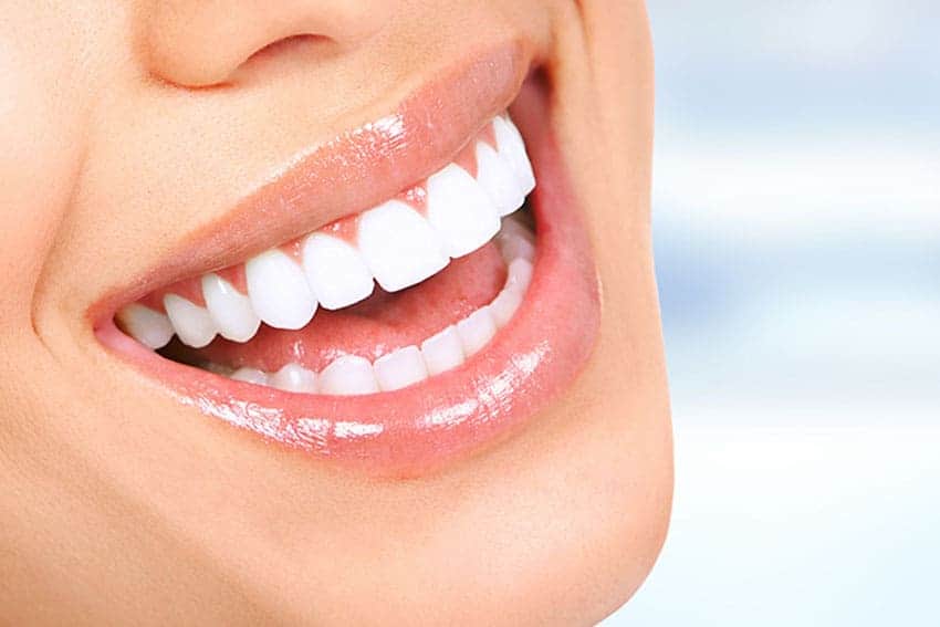 Teeth Whitening Abingdon Essex