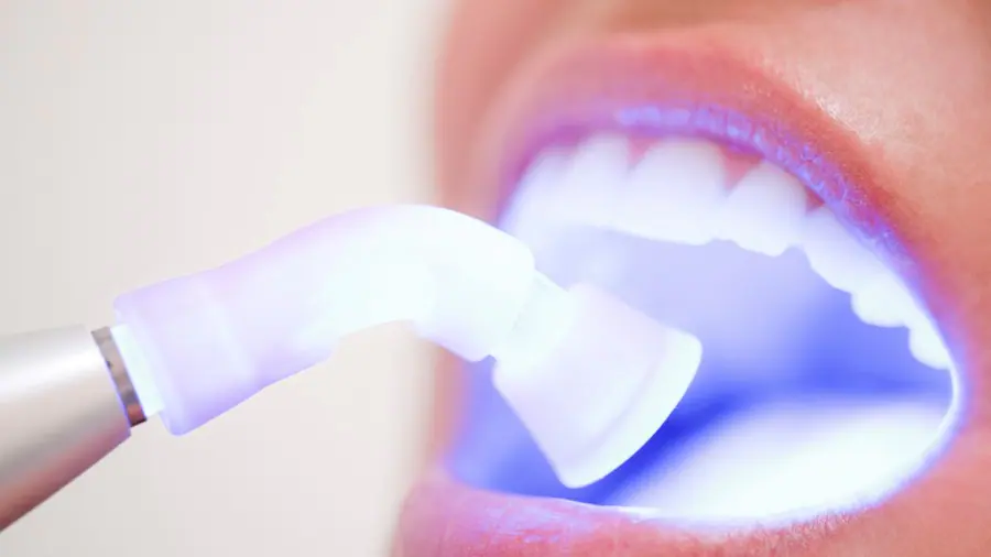 Teeth Whitening Aylesbury Essex