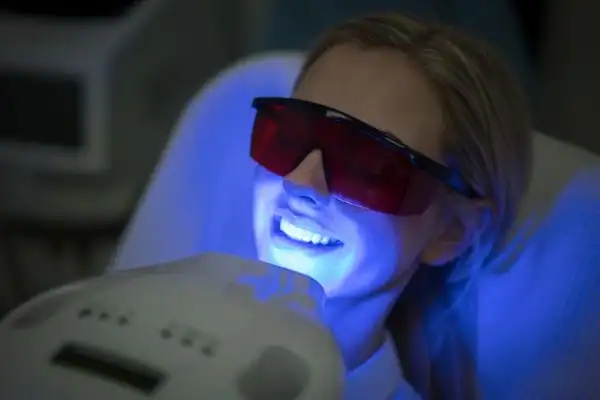 How Long Do the Effects of Laser Teeth Whitening Last Essex